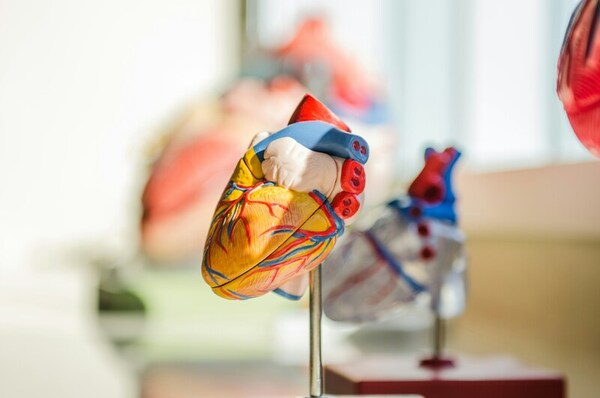 Diagnosing hypertrophic cardiomyopathy using machine learning models on CMRs and EKGs of the heart